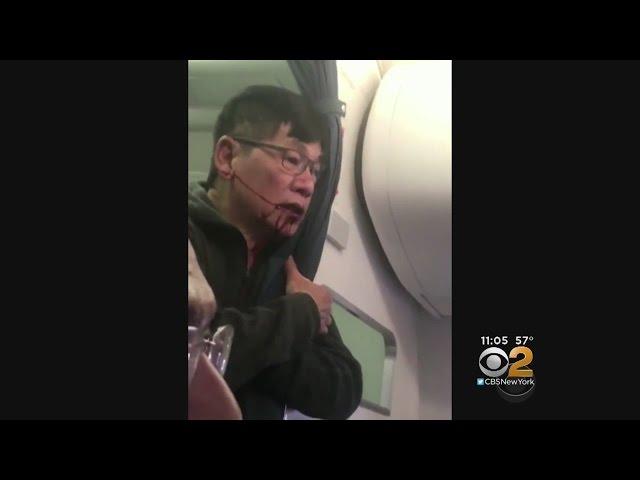 United Settles With Dr. David Dao