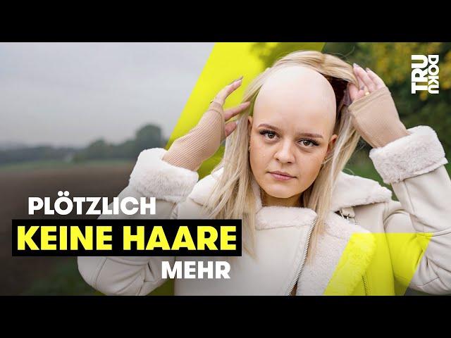 Im Urlaub: Leonie (22) verliert fast alle Haare | TRU DOKU