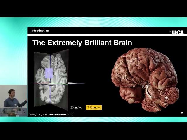 8th BigBrain Workshop 2024: The Extremely Brilliant Brain - The Isotropic Micrometric Human Brain...