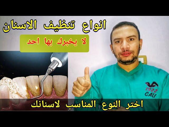 انواع تنظيف الاسنان عند طبيب الاسنان اختر النوع المناسب لاسنانك