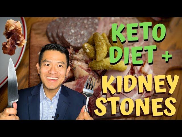 Keto Diet and Kidney Stones | How can Ketogenesis Cause Kidney Stones? Explained by Dr. Robert Chan