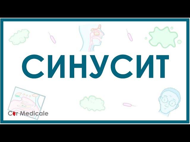 Синусит: механизм развития, симптомы, диагностика, лечение - кратко