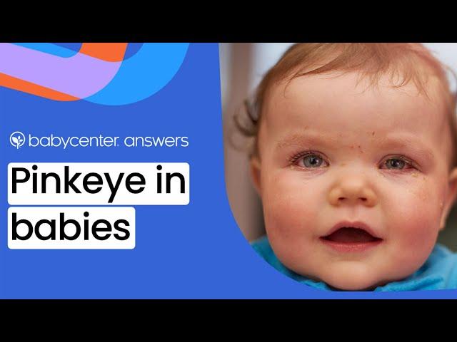 Pinkeyes in babies