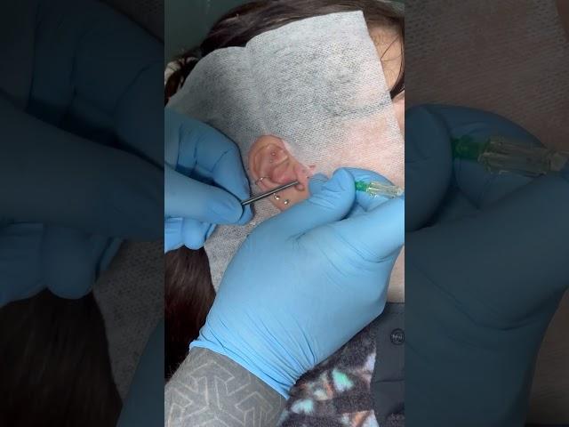 #DoubleTragus #Piercing by Jabba done in #GetPierced #CarlisleCumbria #UKPiercing #UKPiercer