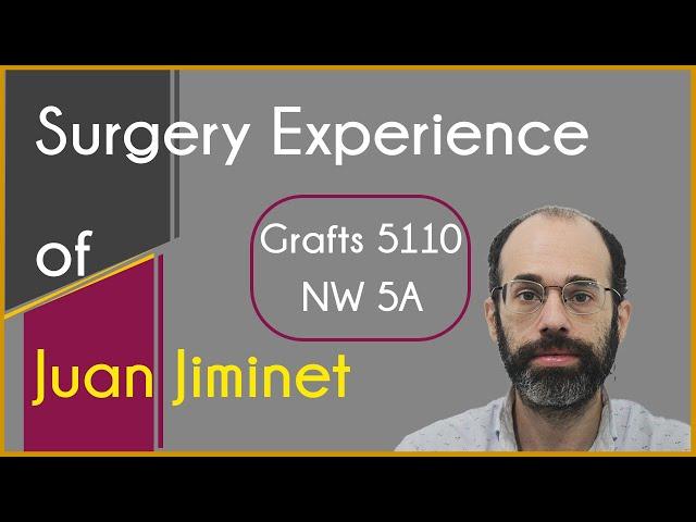 Juan Jiminet shares his hair transplantation surgery experience at Eugenix India by Dr. Arika Bansal