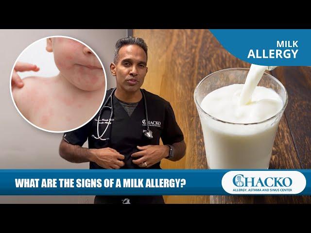 What Are the Signs of a Milk Allergy? [Chacko Allergy]