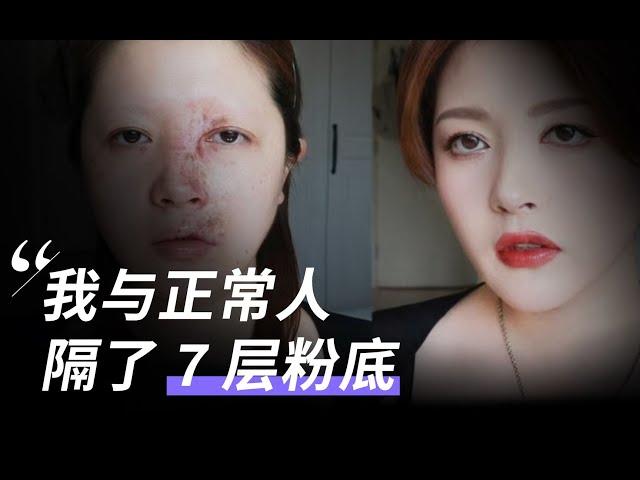 满脸疤痕的我，做了美妆 UP 主【亲历者说】