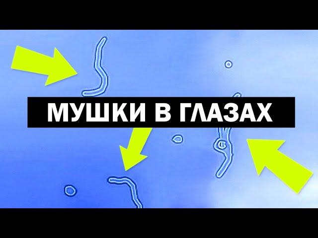 ЧЕМ ОНИ ОПАСНЫ? ВСЯ ПРАВДА О ПЛАВАЮЩИХ МУШКАХ / (об этом никто не говорит)