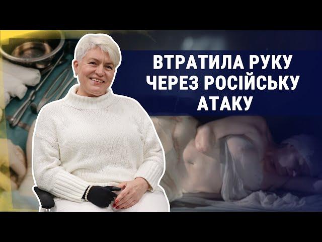 Життя після ампутації. Як херсонка відновлюється після обстрілу РФ?