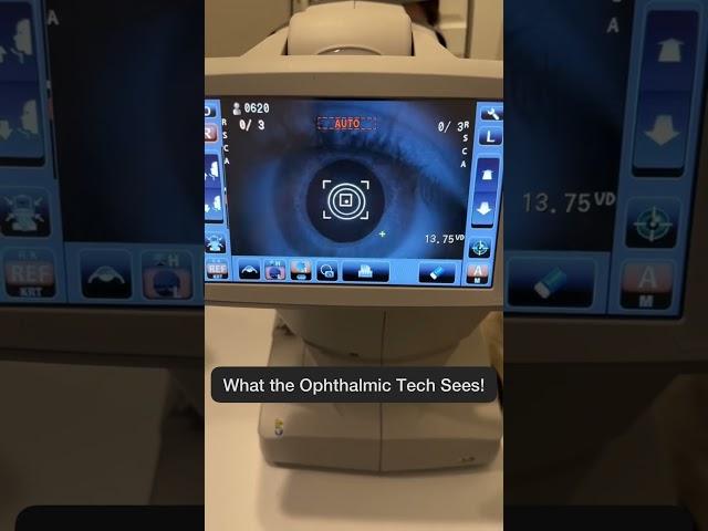 What We SEE vs What You SEE #eyetest #autorefractor #eyecare