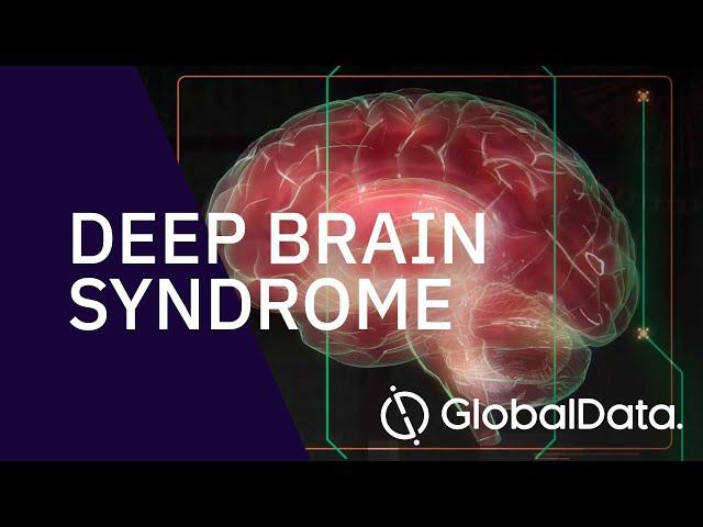 Deep Brain Stimulators - Industry Insight & Market Forecast