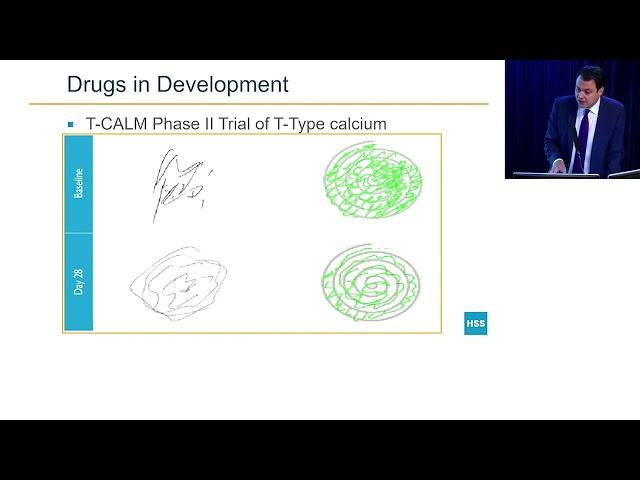 Essential Tremor: HSS