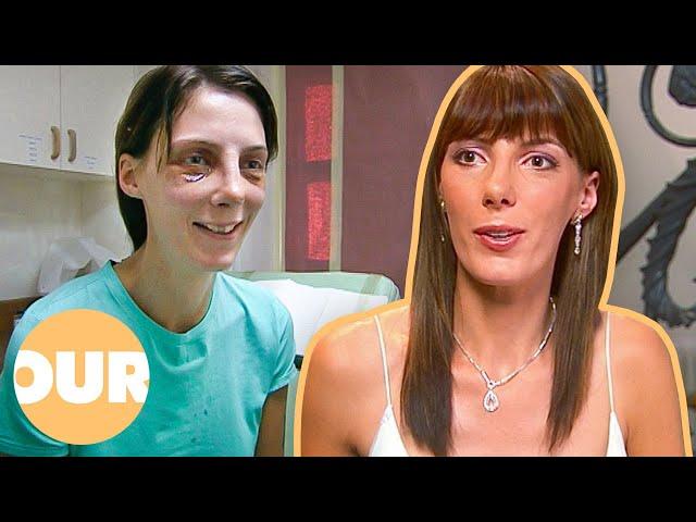 Plastic Surgery Changed My Life | Our Life