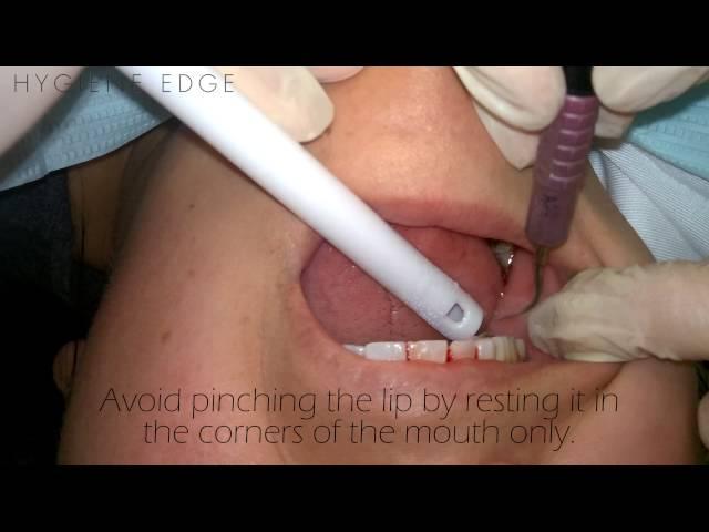 How To hold/Use The Highspeed Suction- Assisting Tips For The Hygienist