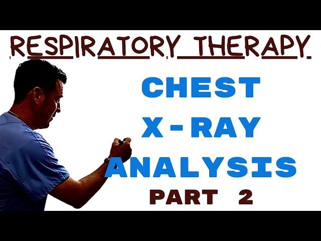 Respiratory Therapist - Chest Radiograph Interpretation Part 2 - Guess the CXR!