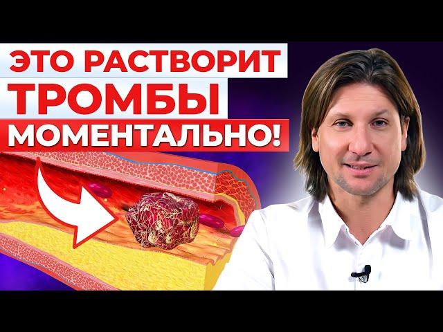 ЭТИ продукты разжижают ТРОМБЫ! Как спасти себя от тромбоза?