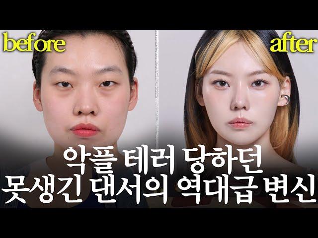 외모 조롱 받는 게 일상인 댄서의 역대급 성형 후기｜MAKE ME Girl