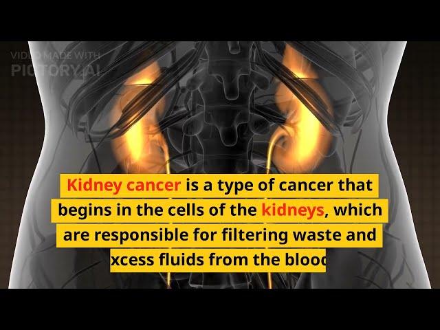 Kidney Cancer Treatment || 2023||  in English || @DrUmeAiman