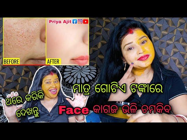 Home Remedies For Open Pores, Large Pores Treatment at home / Priya Ajit Vlogs