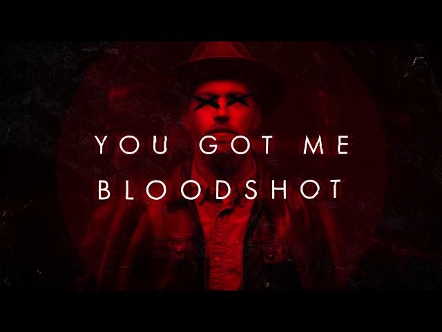 Sam Tinnesz - Bloodshot [Official Lyric Video]