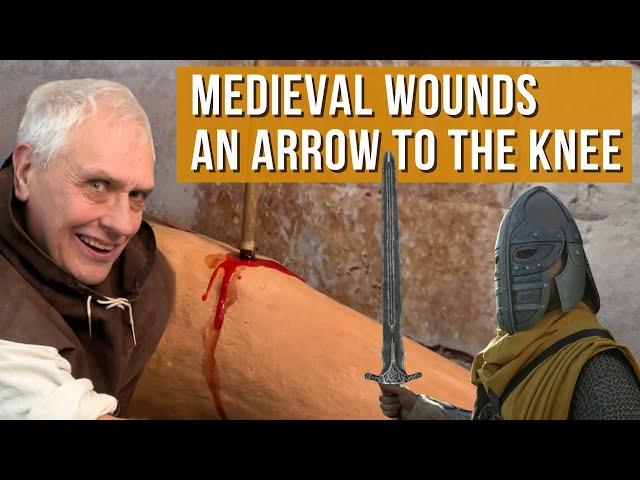 Medieval Wounds | What happens when you take an arrow to the knee?