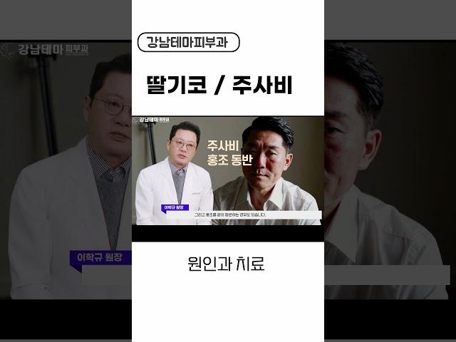딸기코 주사비 원인과 치료 방법 #주사비#딸기코