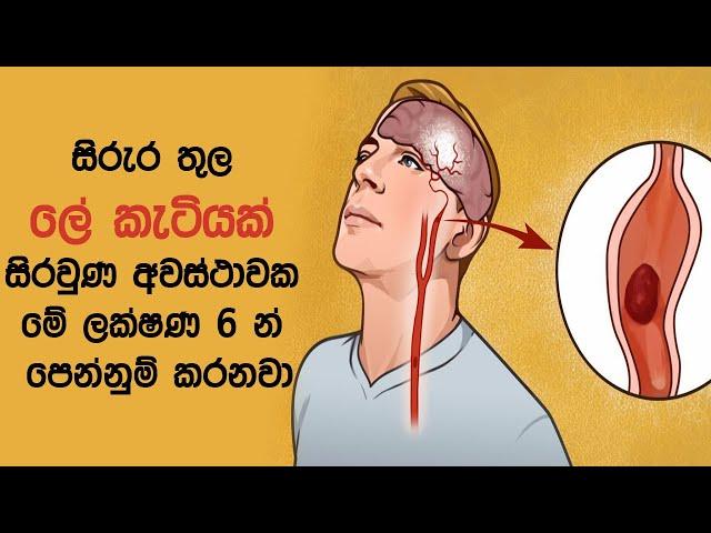 සිරුර තුල ලේ කැටියක් සිරවුණ අවස්ථාවක මේ ලක්ෂණ 6 න් පෙන්නුම් කරනවා