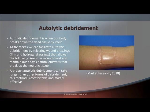 OTVIJAY Stages of Wound Healing & Debridement