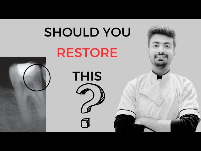 Should you fill this tooth?| only 1% Dentists know this |Dental ji| Hindi