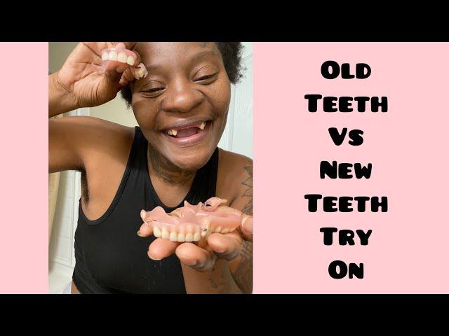 #dentures #whoisshonda #drheavenly New dentures vs old dentures try on