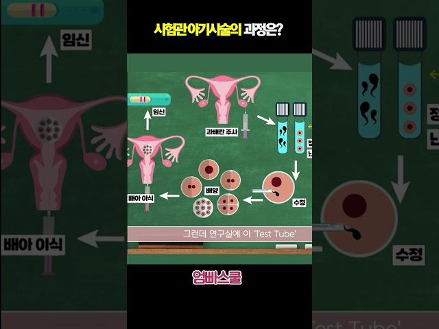 시험관 아기 시술의 과정은??