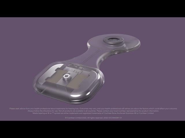 Osia Implant’s Piezo Power transducer