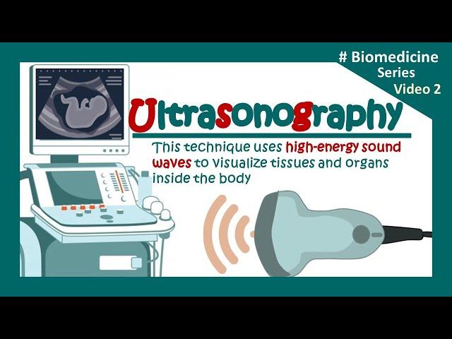 Ultrasonography | USG | The Principles of Ultrasound Imaging | Clinical application of USG | Biology