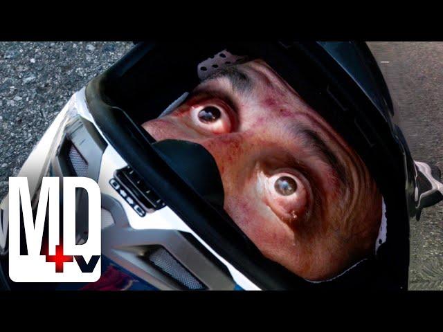 Medic Pops Man's Eyes Back Into His Head | Trauma | MD TV