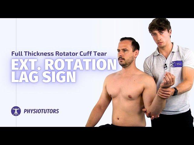 External Rotation Lag Sign | Full Thickness Rotator Cuff Tears