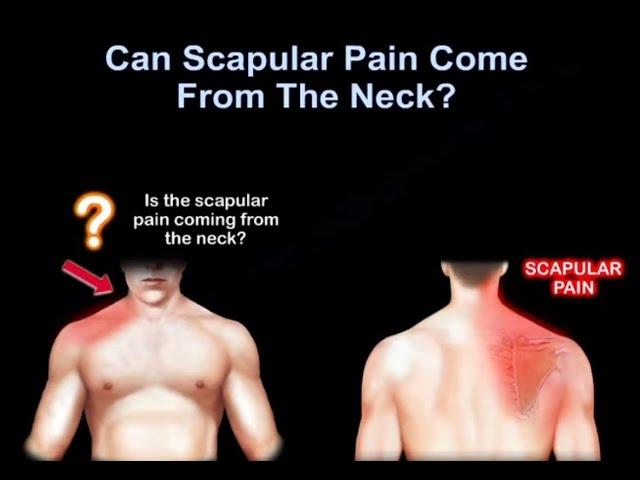 Neck pain or shoulder pain,  WHY IT HURTS.