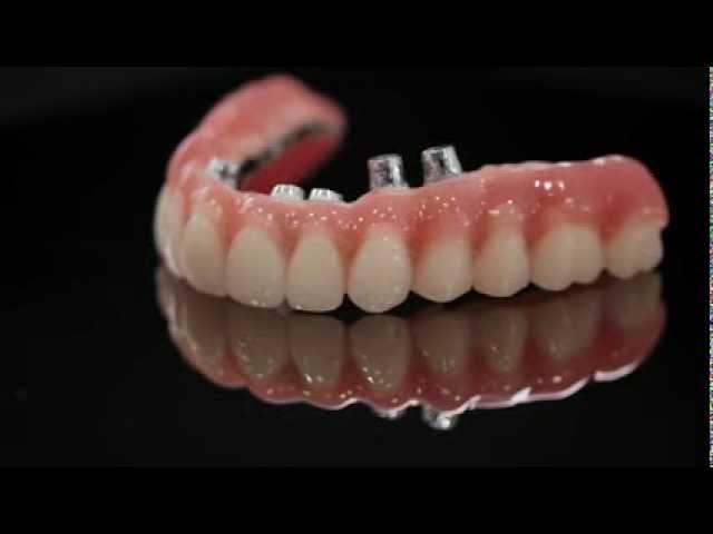 K Dental Lab Implant-2.mov