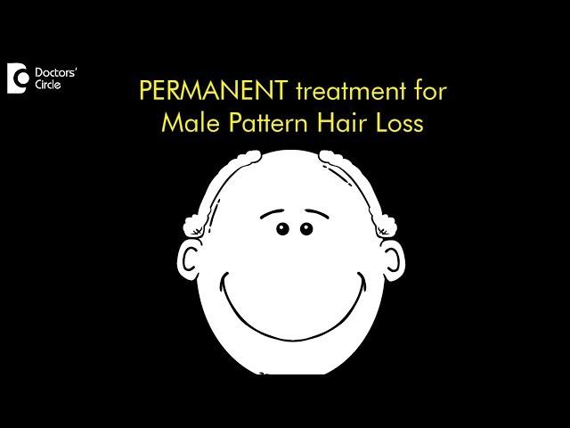 Is there a permanent treatment for male pattern hair loss? - Dr. Nischal K