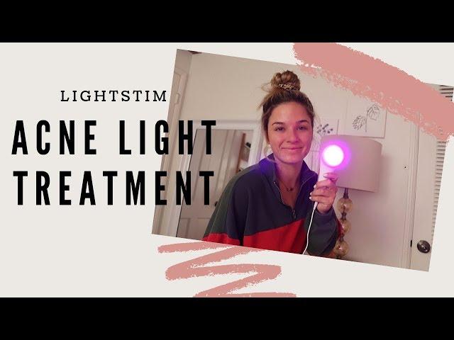 ACNE CLEARING LIGHT || LIGHTSTIM