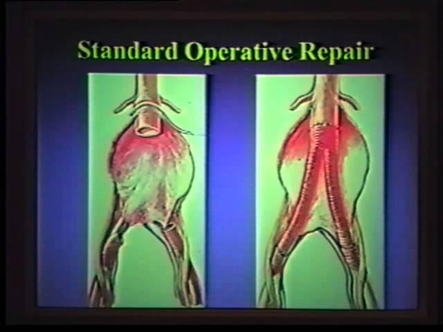Dolan Lecture Series 2002 - Barry T. Katzen, MD
