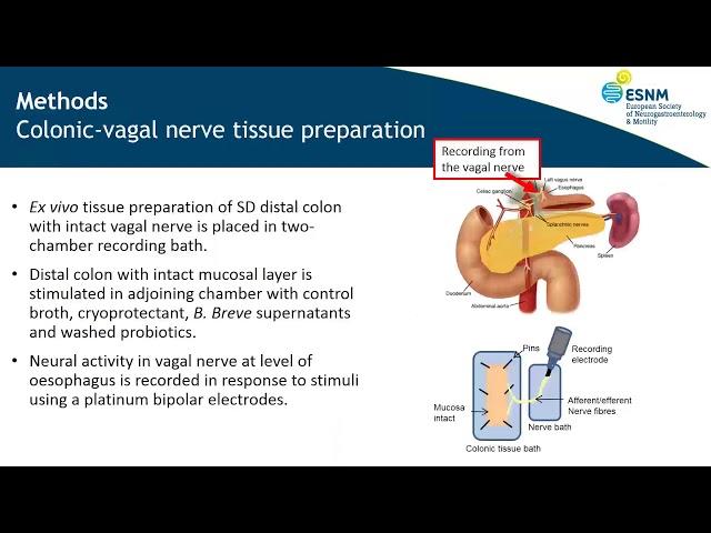Bifidobacterium Breve NCFB 2258 stimulates vagal nerve firing across by Dervla O'Malley