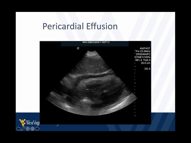 M4 Surgical Skills 2021 POCUS in Trauma, The FAST Exam