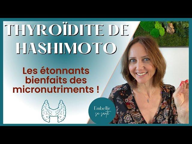 Hypothyroïdie d’Hashimoto, régime alimentaire et solutions naturelles