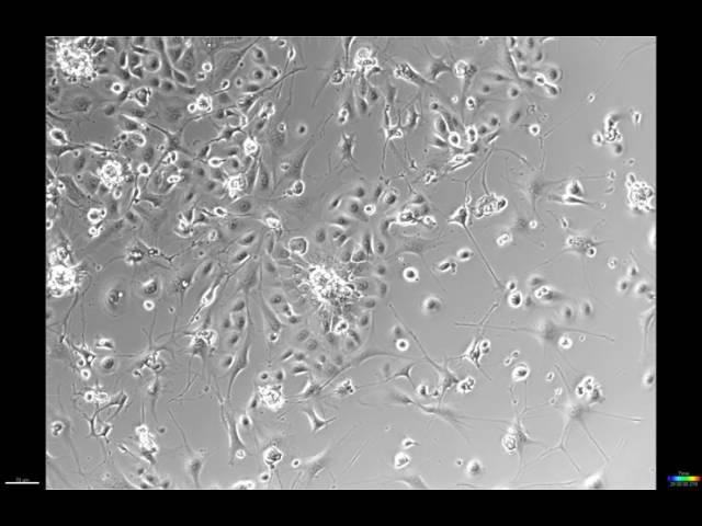 Time lapse of skin cells, known as keratinocytes, growing in the lab