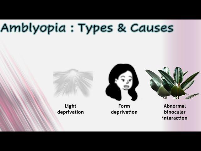 Amblyopia 1│ Types & causes