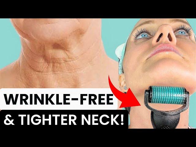 HOW TO GET A YOUNGER LOOKING NECK WITH 0.75MM DERMAROLLER - FIX NECK LINES, WRINKLES, SAGGY NECK