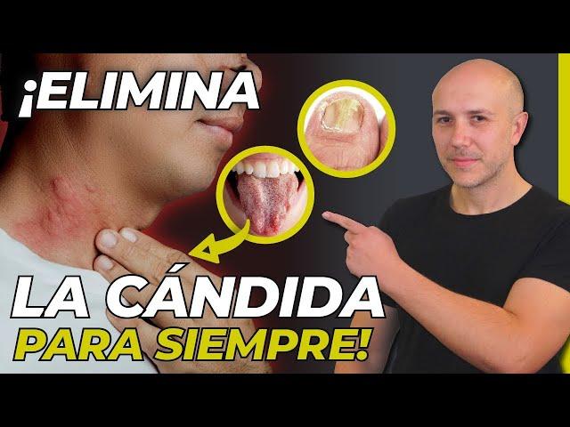 ¡ATENCIÓN! GUÍA COMPLETA PARA ENTENDER Y ELIMINAR LA CÁNDIDA DE TU CUERPO | SIGNOS DE CÁNDIDA