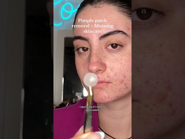 MORNING SKINCARE FOR ACNE PRONE SKIN #beautytips #acnepositivity #skincare #grwmroutine