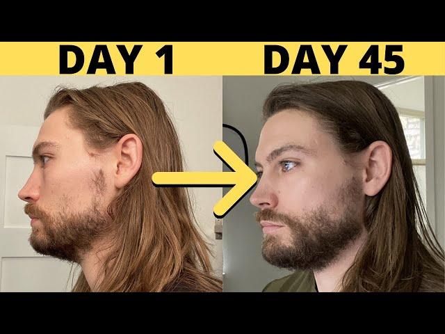 How To Grow MORE Facial Hair (WITHOUT MINOXIDIL)