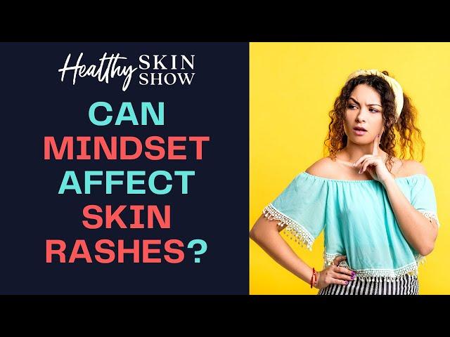 MINDSET And Skin Rashes | Jennifer Fugo